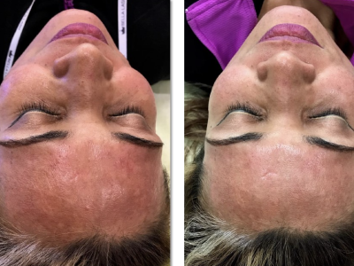 Screenshot 2025-03-04 at 4.35.52 PM